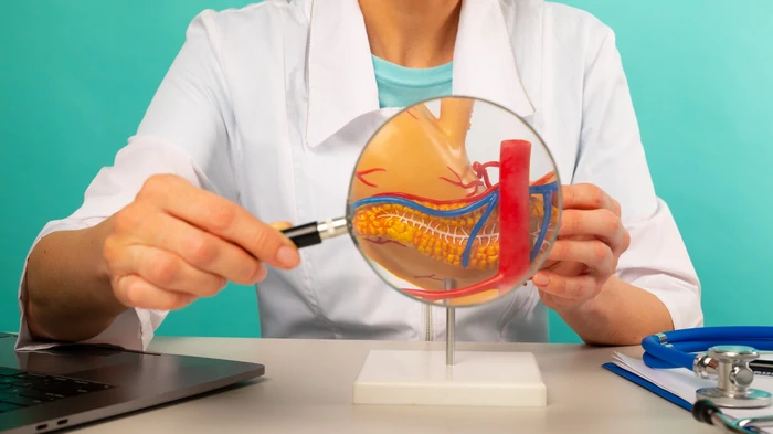 kirurgija holecistostome